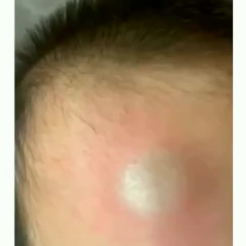 Achadinho 2